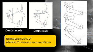 Condylaraxis Corpusaxis
Normal value: 260+/-20
A total of 30 increase is seen every 5 year
 