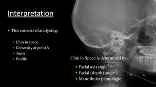 Interpretation
 This consists ofanalyzing:
 Chin in space
 Convexity at pointA
 Teeth
 Profile
 Facial axisangle
 Facial (depth) angle
 Mandibular planeangle
Chin in Space is determined by:
 