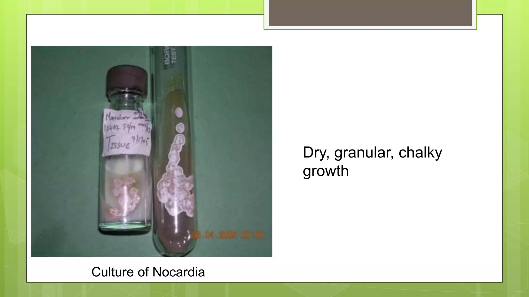 Culture of Nocardia
Dry, granular, chalky
growth
 