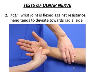 TESTS OF ULNAR NERVE
1. FCU : wrist joint is flexed against resistance,
hand tends to deviate towards radial side
 
