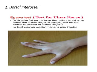 2. Dorsal Interossei :
 