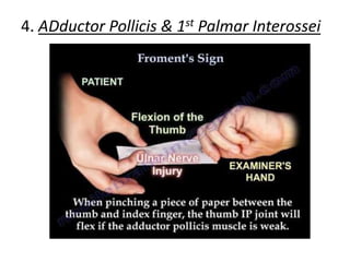 4. ADductor Pollicis & 1st Palmar Interossei
 