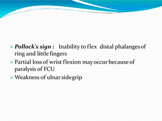 Pollock's sign : Inability to flex distal phalangesof
ring and littlefingers
Partial lossof wrist flexion mayoccur becauseof
paralysis of FCU
Weakness of ulnar sidegrip
 