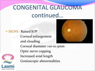 CONGENITAL GLAUCOMA
continued…
 SIGNS : Raised IOP
Corneal enlargement
and clouding
Corneal diameter >10-10.5mm
Optic nerve cupping
Increased axial length
Gonioscopic abnormalities
 
