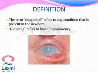 DEFINITION
 The term “congenital” refers to any condition that is
present in the newborn.
 “Clouding” refers to loss of transparency.
 