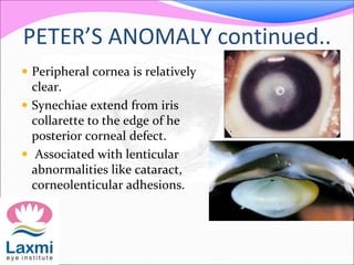 PETER’S ANOMALY continued..
 Peripheral cornea is relatively
clear.
 Synechiae extend from iris
collarette to the edge of he
posterior corneal defect.
 Associated with lenticular
abnormalities like cataract,
corneolenticular adhesions.
 