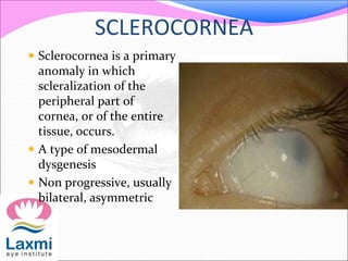SCLEROCORNEA
 Sclerocornea is a primary
anomaly in which
scleralization of the
peripheral part of
cornea, or of the entire
tissue, occurs.
 A type of mesodermal
dysgenesis
 Non progressive, usually
bilateral, asymmetric
 