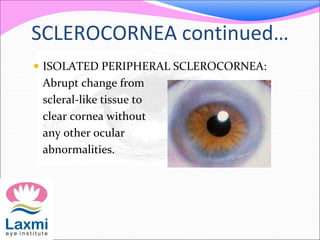 SCLEROCORNEA continued…
 ISOLATED PERIPHERAL SCLEROCORNEA:
Abrupt change from
scleral-like tissue to
clear cornea without
any other ocular
abnormalities.
 