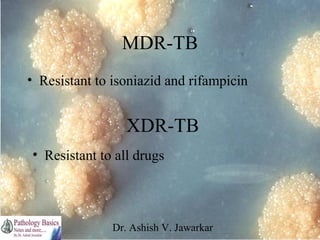 MDR-TB
• Resistant to isoniazid and rifampicin

XDR-TB
• Resistant to all drugs

Dr. Ashish V. Jawarkar

 