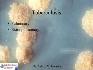Tuberculosis
• Pulmonary
• Extra pulmonary

Dr. Ashish V. Jawarkar

 