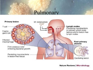 Pulmonary

Dr. Ashish V. Jawarkar

 