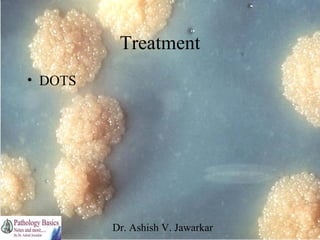 Treatment
• DOTS

Dr. Ashish V. Jawarkar

 