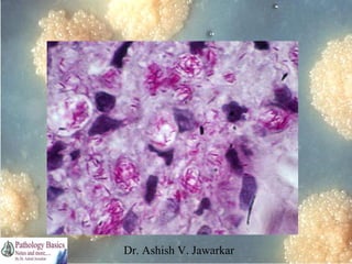 Dr. Ashish V. Jawarkar

 