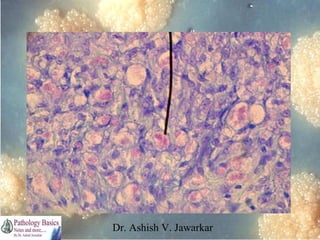 Dr. Ashish V. Jawarkar

 