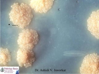 • ----

Dr. Ashish V. Jawarkar

 