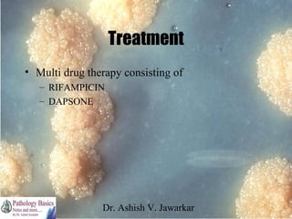 Treatment
• Multi drug therapy consisting of
– RIFAMPICIN
– DAPSONE

Dr. Ashish V. Jawarkar

 