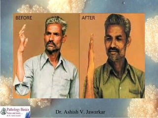 Dr. Ashish V. Jawarkar

 