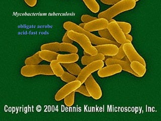 3 
MMyyccoobbaacctteerriiuumm ttuubbeerrccuulloossiiss 
oobblliiggaattee aaeerroobbee 
aacciidd--ffaasstt rrooddss 
 