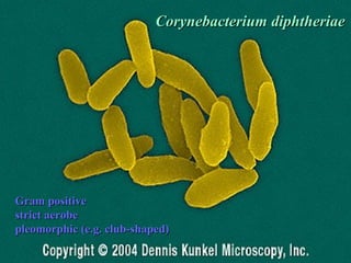 CCoorryynneebbaacctteerriiuumm ddiipphhtthheerriiaaee 
34 
GGrraamm ppoossiittiivvee 
ssttrriicctt aaeerroobbee 
pplleeoommoorrpphhiicc ((ee..gg.. cclluubb--sshhaappeedd)) 
 