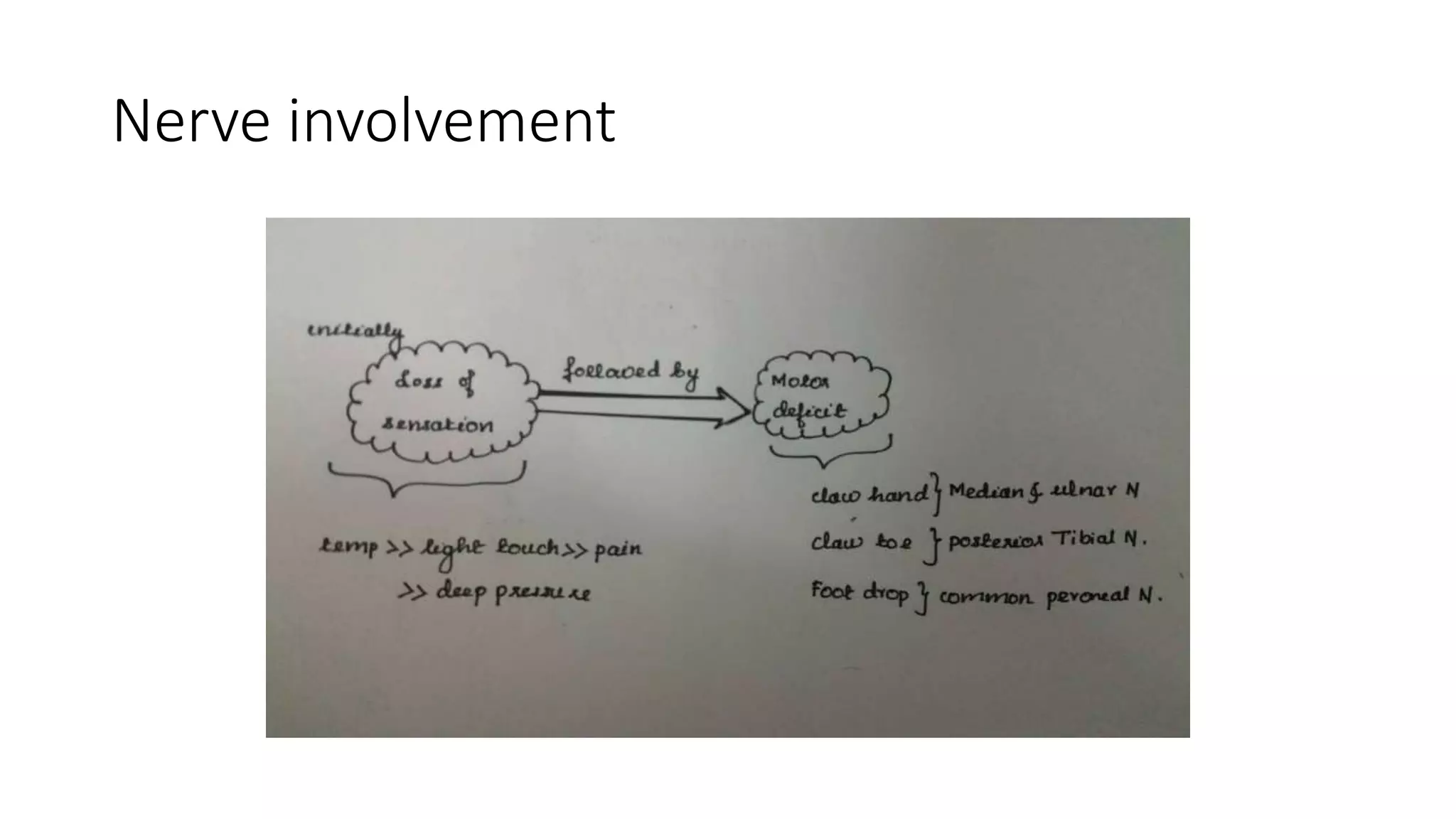 Nerve involvement
 