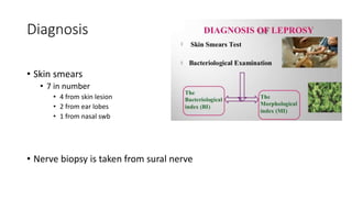 Diagnosis
• Skin smears
• 7 in number
• 4 from skin lesion
• 2 from ear lobes
• 1 from nasal swb
• Nerve biopsy is taken from sural nerve
 