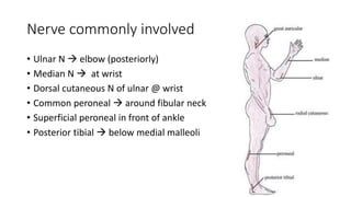 Nerve commonly involved
• Ulnar N  elbow (posteriorly)
• Median N  at wrist
• Dorsal cutaneous N of ulnar @ wrist
• Common peroneal  around fibular neck
• Superficial peroneal in front of ankle
• Posterior tibial  below medial malleoli
 