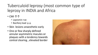 Tuberculoid leprosy (most common type of
leprosy in INDIA and Africa
• CMI ↑↑
• Lepromin +ve
• Bacillary load ↓↓
• Skin lesions anaesthetic early
• One or few sharply defined
annular asymmetric macules or
plaques with a tendency towards
central clearing , elevated border
 