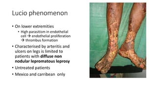 Lucio phenomenon
• On lower extremities
• High parasitism in endothelial
cell  endothelial proliferation
 thrombus formation
• Characterised by arteritis and
ulcers on legs is limited to
patients with diffuse non
nodular lepromatous leprosy
• Untreated patients
• Mexico and carribean only
 