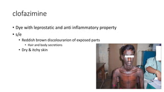 clofazimine
• Dye with leprostatic and anti inflammatory property
• s/e
• Reddish brown discolourarion of exposed parts
• Hair and body secretions
• Dry & itchy skin
 