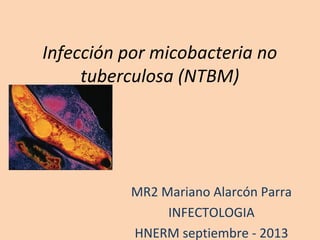 Infección por micobacteria no
tuberculosa (NTBM)
MR2 Mariano Alarcón Parra
INFECTOLOGIA
HNERM septiembre - 2013
 