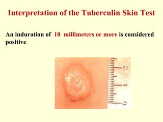 Mycobacteria - Prac. Microbiology | PPT