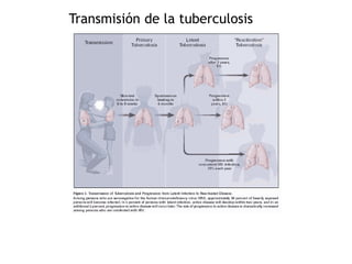 Transmisión de la tuberculosis
 