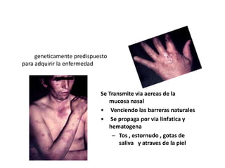 Lepra
• Para contagiarse se necesita convivir
con el paciente por largo tiempo y
estar geneticamente predispuesto
para adquirir la enfermedad
Se Transmite via aereas de la
mucosa nasal
• Venciendo las barreras naturales
• Se propaga por via linfatica y
hematogena
– Tos , estornudo , gotas de
saliva y atraves de la piel
 
