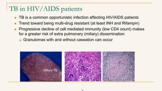 TB in HIV/AIDS patients
 TB is a common opportunistic infection affecting HIV/AIDS patients
 Trend toward being multi-drug resistant (at least INH and Rifampin)
 Progressive decline of cell mediated immunity (low CD4 count) makes
for a greater risk of extra pulmonary (miliary) dissemination
 Granulomas with and without caseation can occur
Miliary TB
 