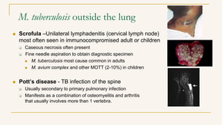 M. tuberculosis outside the lung
 Scrofula –Unilateral lymphadenitis (cervical lymph node)
most often seen in immunocompromised adult or children
 Caseous necrosis often present
 Fine needle aspiration to obtain diagnostic specimen
 M. tuberculosis most cause common in adults
 M. avium complex and other MOTT (2-10%) in children
 Pott’s disease - TB infection of the spine
 Usually secondary to primary pulmonary infection
 Manifests as a combination of osteomyelitis and arthritis
that usually involves more than 1 vertebra.
 