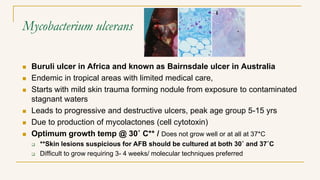 Mycobacterium ulcerans
 Buruli ulcer in Africa and known as Bairnsdale ulcer in Australia
 Endemic in tropical areas with limited medical care,
 Starts with mild skin trauma forming nodule from exposure to contaminated
stagnant waters
 Leads to progressive and destructive ulcers, peak age group 5-15 yrs
 Due to production of mycolactones (cell cytotoxin)
 Optimum growth temp @ 30˚ C** / Does not grow well or at all at 37*C
 **Skin lesions suspicious for AFB should be cultured at both 30˚ and 37˚C
 Difficult to grow requiring 3- 4 weeks/ molecular techniques preferred
 