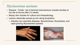 Mycobacterium marinum
 Disease: Tender, red or blue/red subcutaneous nodules develop at
the site of trauma after 2-3 weeks
 Biopsy skin nodules for culture and histopathology
 Lesions classically spread up arm along lymphatics,
 Infection can resemble diseases: Sporotrichosis, Nocardiosis, and
rapid growing Mycobacteria species
 