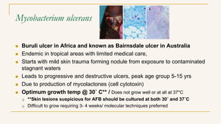 Mycobacterium ulcerans
 Buruli ulcer in Africa and known as Bairnsdale ulcer in Australia
 Endemic in tropical areas wit...
