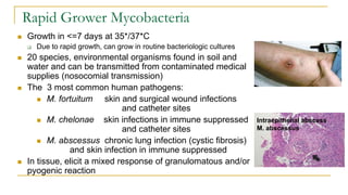  Growth in <=7 days at 35*/37*C
 Due to rapid growth, can grow in routine bacteriologic cultures
 20 species, environmental organisms found in soil and
water and can be transmitted from contaminated medical
supplies (nosocomial transmission)
 The 3 most common human pathogens:
 M. fortuitum skin and surgical wound infections
and catheter sites
 M. chelonae skin infections in immune suppressed
and catheter sites
 M. abscessus chronic lung infection (cystic fibrosis)
and skin infection in immune suppressed
 In tissue, elicit a mixed response of granulomatous and/or
pyogenic reaction
Rapid Grower Mycobacteria
Intraepithelial abscess
M. abscessus
 