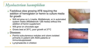 Mycobacterium haemophilum
 Fastidious slow growing AFB requiring the
addition of hemoglobin or hemin to culture media
for growth
 Will not grow on LJ media, Middlebrook, or in automated
system media (Middlebrook 12B media) without the
addition of hemin supplement
 Will grow on chocolate agar
 Grows best at 30*C, poor growth at 37*C
 Diseases:
 Painful subcutaneous nodules and ulcers isolated
primarily in patient with AIDS patients or
immunosuppressed
 Lymphadenitis in children
 