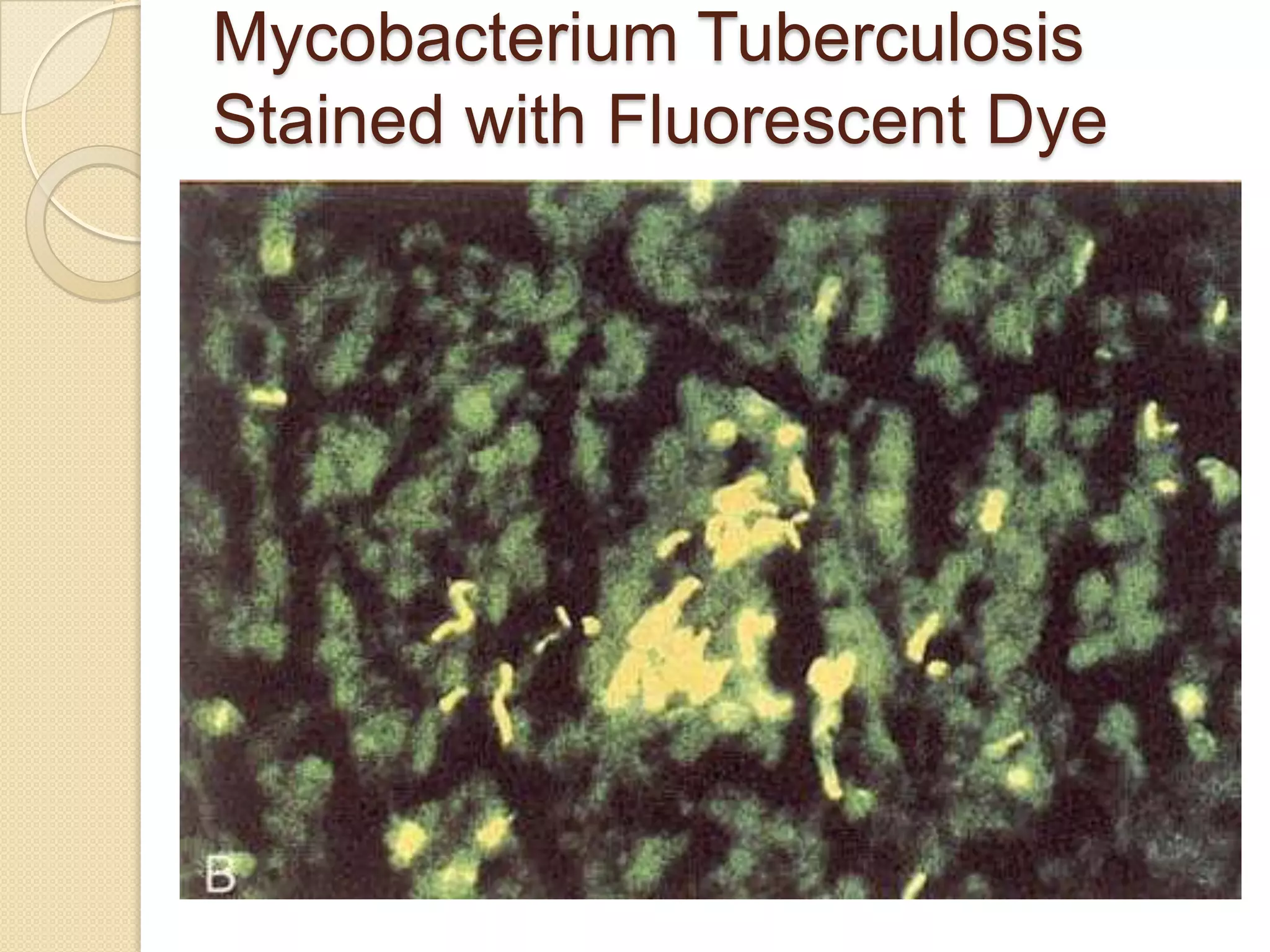 Mycobacterium Tuberculosis
Stained with Fluorescent Dye
 