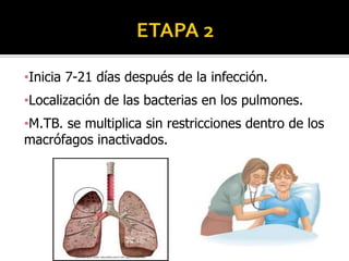•Inicia 7-21 días después de la infección.
•Localización de las bacterias en los pulmones.
•M.TB. se multiplica sin restricciones dentro de los
macrófagos inactivados.

 