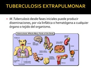 

M. Tuberculosis desde fases iniciales puede producir
diseminaciones, por vía linfática o hematógena a cualquier
órgano o tejido del organismo.

 