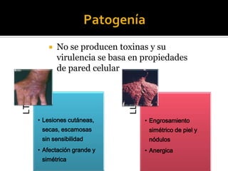 No se producen toxinas y su
virulencia se basa en propiedades
de pared celular

LL

LT



• Lesiones cutáneas,

• Engrosamiento

secas, escamosas

simétrico de piel y

sin sensibilidad

nódulos

• Afectación grande y
simétrica

• Anergica

 