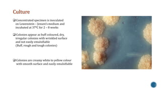 Culture 
 Concentrated specimen is inoculated 
on Lowenstein – Jensen’s medium and 
incubated at 370C for 2 – 8 weeks 
 Colonies appear as buff coloured, dry, 
irregular colonies with wrinkled surface 
and not easily emulsifiable 
(Buff, rough and tough colonies) 
 Colonies are creamy white to yellow colour 
with smooth surface and easily emulsifiable 
 
