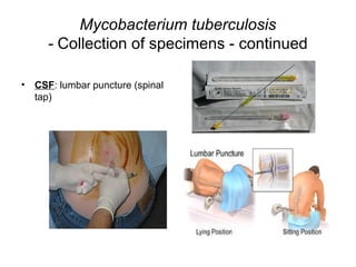 Mycobacterium tuberculosis
- Collection of specimens - continued
• CSF: lumbar puncture (spinal
tap)
 