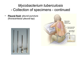 Mycobacterium tuberculosis
- Collection of specimens - continued
• Pleural fluid: pleural puncture
(thoracentesis/ pleural tap)
 