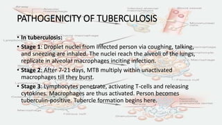 PATΗOGENICITY OF TUBERCULOSIS
• In tuberculosis:
• Stage 1: Droplet nuclei from infected person via coughing, talking,
and sneezing are inhaled. The nuclei reach the alveoli of the lungs,
replicate in alveolar macrophages inciting infection.
• Stage 2: After 7-21 days, MTB multiply within unactivated
macrophages till they burst.
• Stage 3: Lymphocytes penetrate, activating T-cells and releasing
cytokines. Macrophages are thus activated. Person becomes
tuberculin-positive. Tubercle formation begins here.
 
