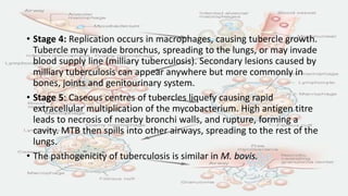 • Stage 4: Replication occurs in macrophages, causing tubercle growth.
Tubercle may invade bronchus, spreading to the lungs, or may invade
blood supply line (milliary tuberculosis). Secondary lesions caused by
milliary tuberculosis can appear anywhere but more commonly in
bones, joints and genitourinary system.
• Stage 5: Caseous centres of tubercles liquefy causing rapid
extracellular multiplication of the mycobacterium. High antigen titre
leads to necrosis of nearby bronchi walls, and rupture, forming a
cavity. MTB then spills into other airways, spreading to the rest of the
lungs.
• The pathogenicity of tuberculosis is similar in M. bovis.
 