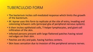 TUBERCULOID FORM
• The bacterium incites cell-mediated response which limits the growth
of the bacterium.
• M. leprae uses this form to replicate at the site of entry, invading and
colonizing Schwann cells (principal glia of peripheral nervous system).
• It then incites epitheloid cells, T-helper lymphocytes, and giant cell
infiltration of the skin.
• Infected persons present with large flattened patches having raised
red edges on their skin.
• Patches are dry and pale, having hairless centers.
• Skin loses sensation due to invasion of the peripheral sensory nerves.
 